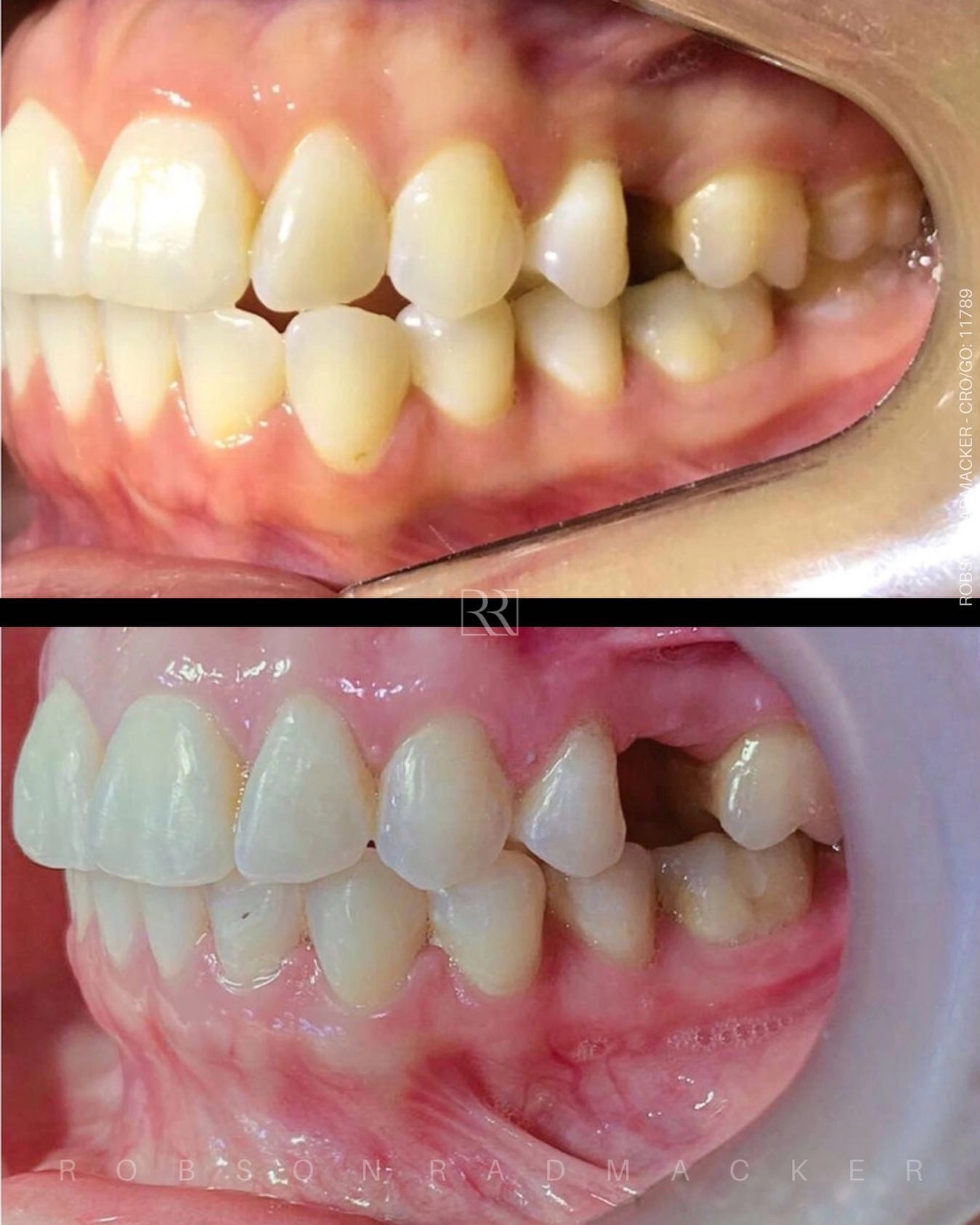 Arquivos Alinhadores Invisalign - Página 3 de 3 - VS Ortodontia